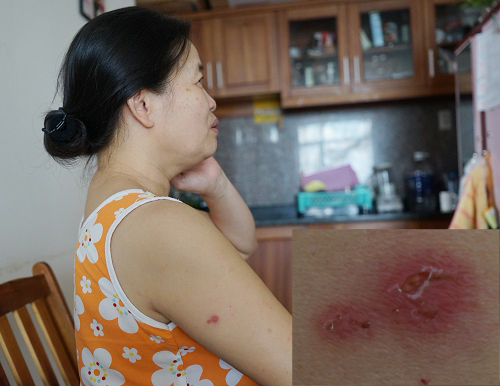KIẾN BA KHOANG TẤN CÔNG CƯ DÂN